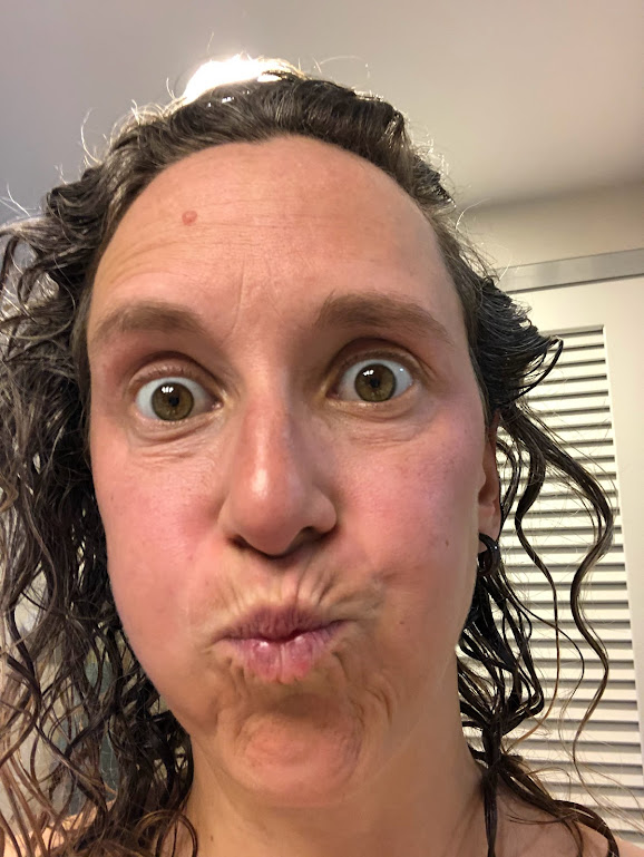Selfie of Laura, whose face completely fills the frame. Her eyes are wide, lips pursed, and cheeks puffed out. Her skin is very red. 
